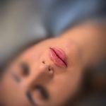 مطب زیبایی دکتر نلسا
