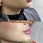 مرکز لیزر ،پوست و زیبایی کندی بیوتی