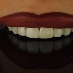 دندانپزشکی دکتر علی منتظمی (بیمه نداریم)