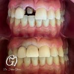 مطب دندانپزشکی دکتر فاطمه قانعی گلبهار