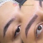 بهترین میکروبلیدینگ و فیبروز خرازی