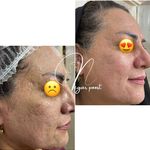 مرکز لیزر و کلینیک پوست و زیبایی نلا