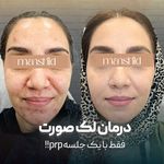 کلینیک زیبایی مانشید