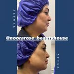 کلینیک زیبایی نورارُز پردیس