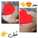 مراقبت پوست زهرا جابری