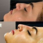 کلینیک زیبایی و مرکز لیزر هانیسا