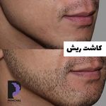 کلینیک زیبایی پوست و مو و لیزر پامچال