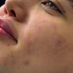 کلینیک زیبایی ولیزر دریا(کندلا آمریکایی)