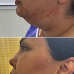 کلینیک زیبایی ولیزر دریا(کندلا آمریکایی)