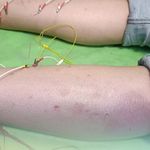 کلینیک فیزیوتراپی تسنیم