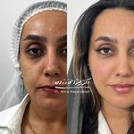 مرکزپوست و مو و لیزر دکتر میترا نجارزاده