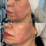 آموزش پاکسازی پوست،مدرس فنی حرفه ای