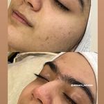 خدمات پوستی میراندا آواک