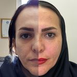 کلینیک پوست و زیبایی ولاغری تاج عظیمیه