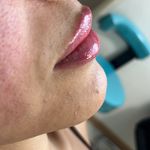 مرکز لیزر لاغری کلینیک زیبایی مهشیدذاكری