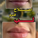 مجموعه زیبایی لاریسا - سمنان - 9663