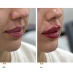 مرکز لیزر و کلینیک زیبایی دکتر با حجب