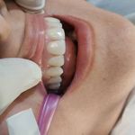 مركز دندانپزشکی دکترفرنوش عیوضی