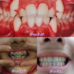 مركز دندانپزشکی دکترفرنوش عیوضی