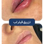 کلینیک زیبایی و جوانسازی پوست و مو الین