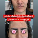 مرکز لیزر و کلینیک زیبایی پریفا