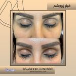 مطب پوست مو زیبایی فردوس شرق