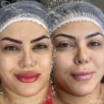 مرکز ریموو و آرایش دائم فرشته سوداگران