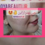 کلینیک زیبایی و درمانی  رویابیوتی