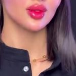 خدمات تخصصی ژل بوتاکس لیزر فیل بیوتی