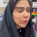کلینیک ژل بوتاکس لیزر فیل بیوتی