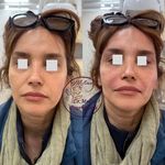 مطب  دکتر ملینا پورکاظمی