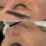 خدمات تخصصی پاکسازی پوست فروغ یزدانی