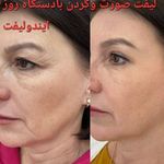 مرکز زیبایی ندا