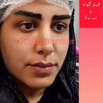 کلینیک لیزروپوست ندا دردرمانگاه امام علی