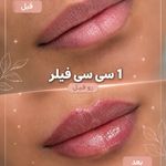 کلینیک پوست،مو،زیبایی،مرکز لیزر ‌پرنسا