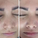 فیشیال و پاکسازی خانم محمدیان