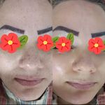 فیشیال و پاکسازی خانم محمدیان