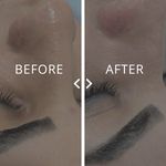پاکسازی و آبرسانی صورت(فیشال)