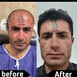 کلینیک کاشت مو سمیه فلاح