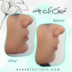 کلینیک پوست و مو آوا