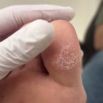خدمات تخصصی پدیکور درمانی شیوا