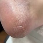 خدمات تخصصی پدیکور درمانی شیوا