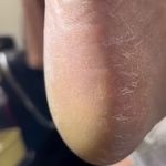 خدمات تخصصی پدیکور درمانی شیوا