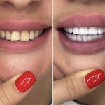 دندانپزشکی دکتر آزاده خلجیان