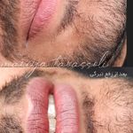 خدمات تخصصی ریموو، شِید لب،بُن مژه ماریا