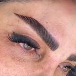 فیبروز تاتوبدن میکرواسکالپ نوشین مهاجر