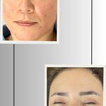 کلینیک فیشیال و پاکسازی پوست صبا