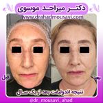 دکترمیراحدموسوی