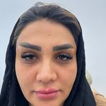 کلینیک ژل بوتاکس لیزر فیل بیوتی