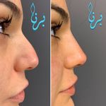 کلینیک زیبایی برنا